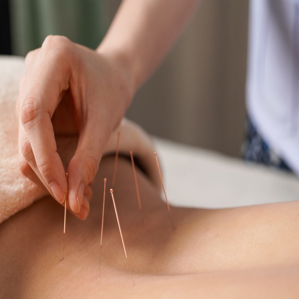 Spa Dew & Acupuncture